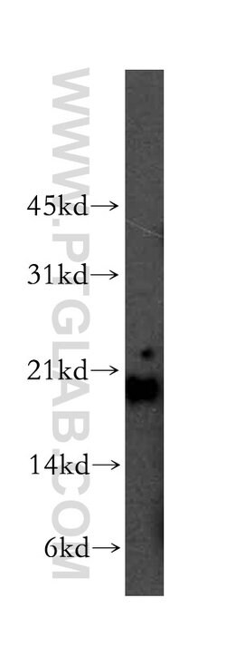 Centrin 1 Rabbit anti-Human, Polyclonal, Proteintech 150 &mu;L; Unconjugated:Antibodies,