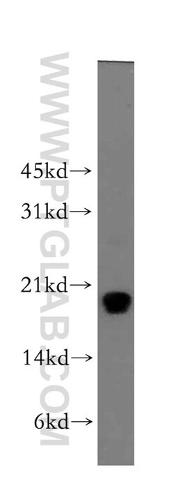 Centrin 1 Rabbit anti-Human, Polyclonal, Proteintech 150 &mu;L; Unconjugated:Antibodies,