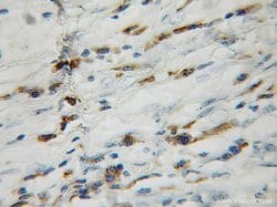 GAGE1 Rabbit anti-Human, Polyclonal, Proteintech 150 &mu;L; Unconjugated:Antibodies,