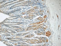SMAP1 Rabbit anti-Human, Mouse, Rat, Polyclonal, Proteintech:Antibodies:Primary