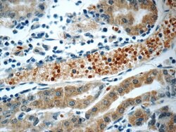 SMAP1 Rabbit anti-Human, Mouse, Rat, Polyclonal, Proteintech:Antibodies:Primary
