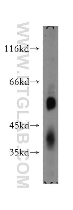 SMAP1 Rabbit anti-Human, Mouse, Rat, Polyclonal, Proteintech