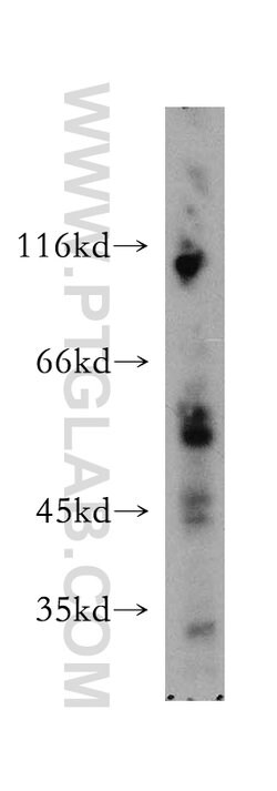 SMAP1 Rabbit anti-Human, Mouse, Rat, Polyclonal, Proteintech:Antibodies:Primary