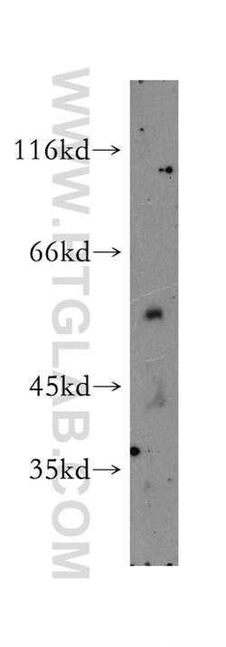 SMAP1 Rabbit anti-Human, Mouse, Rat, Polyclonal, Proteintech:Antibodies:Primary