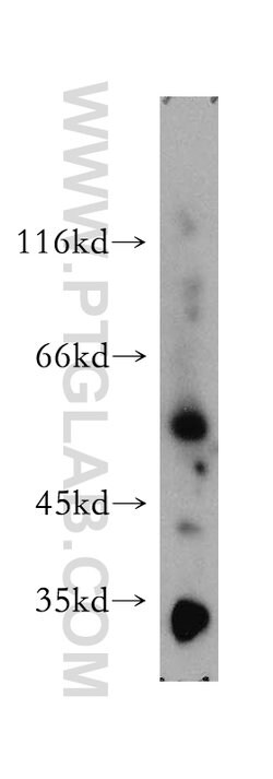 SMAP1 Rabbit anti-Human, Mouse, Rat, Polyclonal, Proteintech:Antibodies:Primary