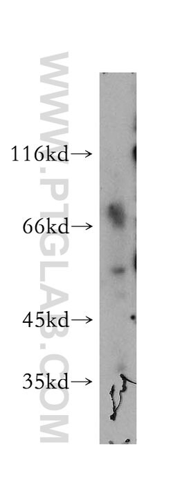SMAP1 Rabbit anti-Human, Mouse, Rat, Polyclonal, Proteintech:Antibodies:Primary