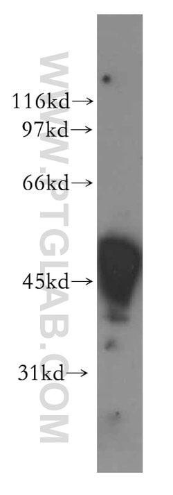 GATM Rabbit anti-Human, Mouse, Rat, Polyclonal, Proteintech 150 &mu;L;