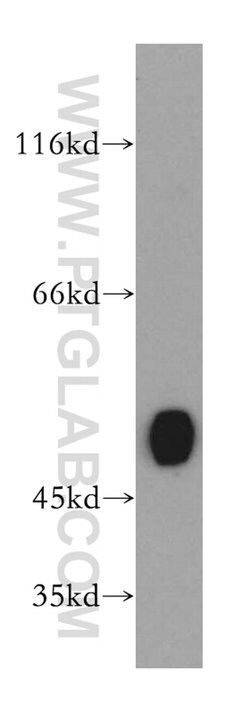 GATM Rabbit anti-Human, Mouse, Rat, Polyclonal, Proteintech 150 &mu;L;