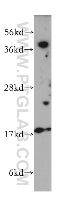 VPS26A Rabbit anti-Human, Mouse, Rat, Polyclonal, Proteintech 20 &mu;L;