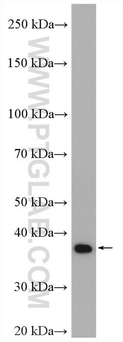 VPS26A Rabbit anti-Human, Mouse, Rat, Polyclonal, Proteintech 20 &mu;L;
