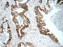 BACE1 Rabbit anti-Human, Mouse, Zebrafish, Polyclonal, Proteintech:Antibodies:Primary