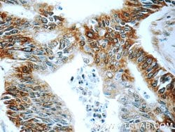 BACE1 Rabbit anti-Human, Mouse, Zebrafish, Polyclonal, Proteintech:Antibodies:Primary