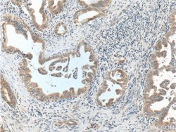 BACE1 Rabbit anti-Human, Mouse, Zebrafish, Polyclonal, Proteintech:Antibodies:Primary