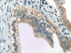 BACE1 Rabbit anti-Human, Mouse, Zebrafish, Polyclonal, Proteintech:Antibodies:Primary