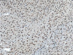 BACE1 Rabbit anti-Human, Mouse, Zebrafish, Polyclonal, Proteintech:Antibodies:Primary