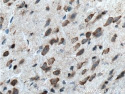 BACE1 Rabbit anti-Human, Mouse, Zebrafish, Polyclonal, Proteintech:Antibodies:Primary