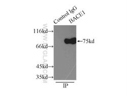 BACE1 Rabbit anti-Human, Mouse, Zebrafish, Polyclonal, Proteintech:Antibodies:Primary