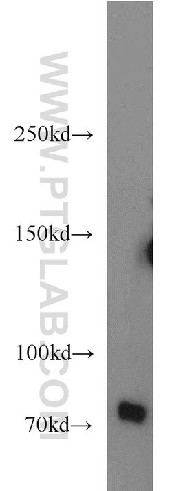 BACE1 Rabbit anti-Human, Mouse, Zebrafish, Polyclonal, Proteintech:Antibodies:Primary