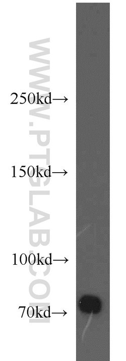 BACE1 Rabbit anti-Human, Mouse, Zebrafish, Polyclonal, Proteintech:Antibodies:Primary
