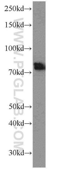 BACE1 Rabbit anti-Human, Mouse, Zebrafish, Polyclonal, Proteintech:Antibodies:Primary