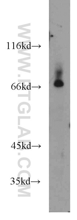 BACE1 Rabbit anti-Human, Mouse, Zebrafish, Polyclonal, Proteintech:Antibodies:Primary