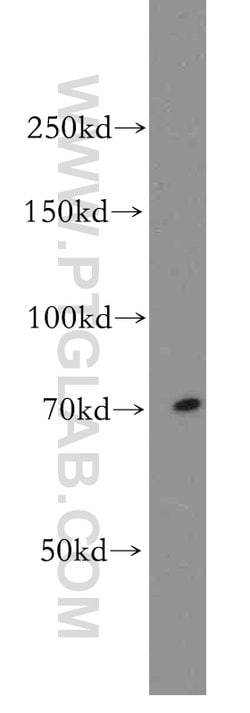 BACE1 Rabbit anti-Human, Mouse, Zebrafish, Polyclonal, Proteintech:Antibodies:Primary