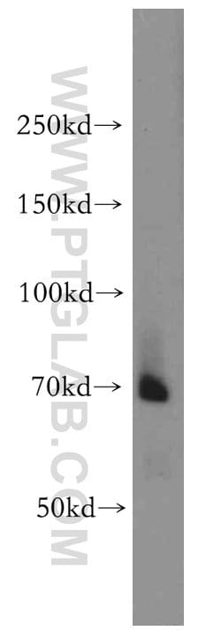 BACE1 Rabbit anti-Human, Mouse, Zebrafish, Polyclonal, Proteintech:Antibodies:Primary