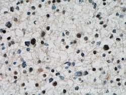 ARNT2 Rabbit anti-Human, Mouse, Rat, Polyclonal, Proteintech 150 &mu;L;