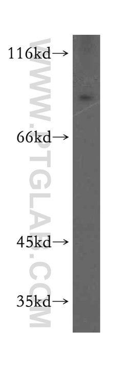 ARNT2 Rabbit anti-Human, Mouse, Rat, Polyclonal, Proteintech 150 &mu;L;