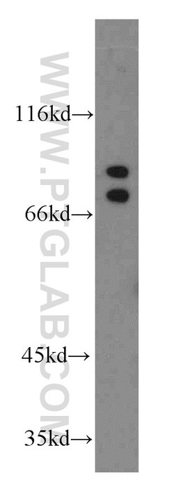 ARNT2 Rabbit anti-Human, Mouse, Rat, Polyclonal, Proteintech 150 &mu;L;