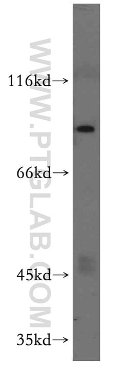 ARNT2 Rabbit anti-Human, Mouse, Rat, Polyclonal, Proteintech 150 &mu;L;