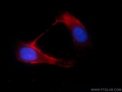 TRPM8 Rabbit anti-Human, Polyclonal, Proteintech:Antibodies:Primary Antibodies