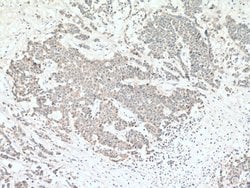 TRPM8 Rabbit anti-Human, Polyclonal, Proteintech:Antibodies:Primary Antibodies