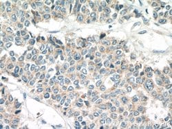 TRPM8 Rabbit anti-Human, Polyclonal, Proteintech:Antibodies:Primary Antibodies