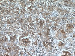 TRPM8 Rabbit anti-Human, Polyclonal, Proteintech:Antibodies:Primary Antibodies