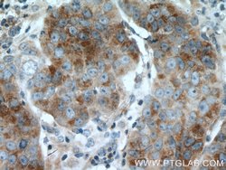 TRPM8 Rabbit anti-Human, Polyclonal, Proteintech:Antibodies:Primary Antibodies