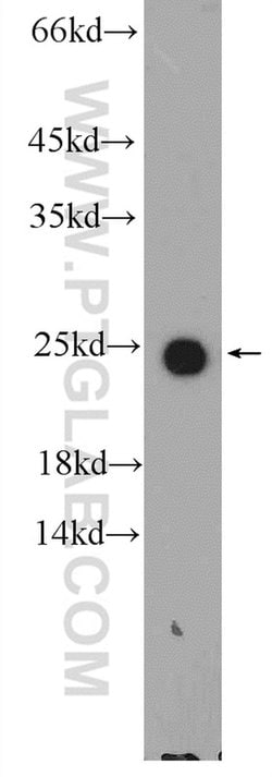 APOM Rabbit anti-Human, Mouse, Rat, Polyclonal, Proteintech 20 &mu;L; Unconjugated:Antibodies,