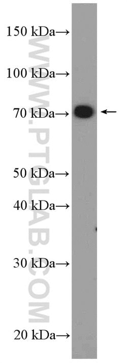SUPV3L1 Rabbit anti-Human, Mouse, Rat, Polyclonal, Proteintech:Anticorps:Anticorps