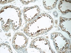 SPACA1 Rabbit anti-Human, Mouse, Rat, Polyclonal, Proteintech 150 &mu;L;