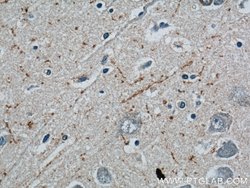 Neuropeptide Y Rabbit anti-Human, Mouse, Polyclonal, Proteintech:Antibodies:Primary