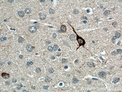 Neuropeptide Y Rabbit anti-Human, Mouse, Polyclonal, Proteintech:Antibodies:Primary