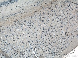Neuropeptide Y Rabbit anti-Human, Mouse, Polyclonal, Proteintech:Antibodies:Primary