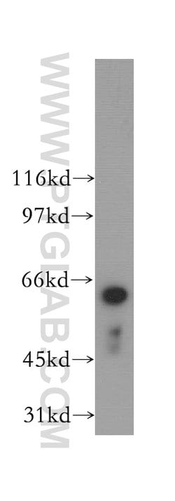 LGTN Rabbit anti-Human, Mouse, Rat, Polyclonal, Proteintech 150 &mu;L;