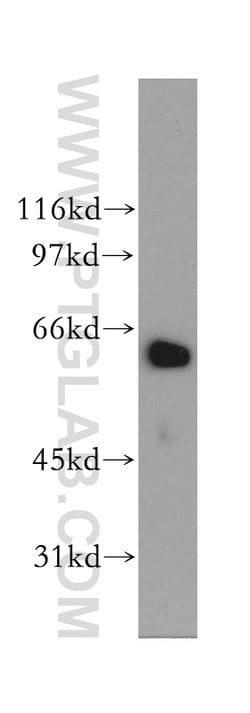 LGTN Rabbit anti-Human, Mouse, Rat, Polyclonal, Proteintech 150 &mu;L;