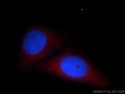 LGTN Rabbit anti-Human, Mouse, Rat, Polyclonal, Proteintech 150 &mu;L;