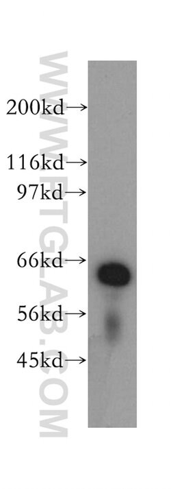 LGTN Rabbit anti-Human, Mouse, Rat, Polyclonal, Proteintech 150 &mu;L;
