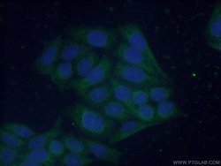 FBP1 Rabbit anti-Human, Mouse, Rat, Polyclonal, Proteintech:Antibodies:Primary