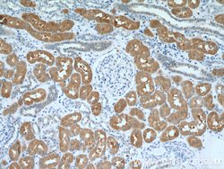FBP1 Rabbit anti-Human, Mouse, Rat, Polyclonal, Proteintech:Antibodies:Primary