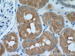FBP1 Rabbit anti-Human, Mouse, Rat, Polyclonal, Proteintech:Antibodies:Primary