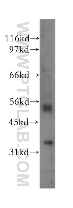 FBP1 Rabbit anti-Human, Mouse, Rat, Polyclonal, Proteintech:Antibodies:Primary